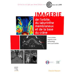 Francis Veillon,Augustin Lecler,Guillaume Poillon,Natalia Shor,Anne-Laure Gaultier,Sophie CAHEN-RIEHM,Loïc Duron,Michael ELIEZER,Alessio Imperiale,Jan Walther Casselman,Patricia Koskas,Guillaume Reverdito,Aurélien Saltel Fuléro,Françoise Héran,Olivier Berges,Monique Elmaleh-Bergès,Arnaud Attyé,Yvonne Purcell Imagerie de l’orbite, du labyrinthe membraneux et de la base du crâne (French Edition)