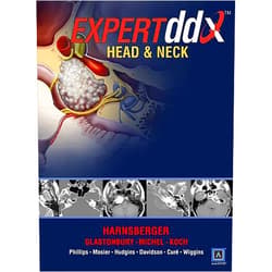 By M.D. Harnsberger, H. Ric (Author), Christine M. Glastonbury (Author), M.D. Michel, Michelle A. (Author), M.D. Koch, Bernadette L. (Author), M.D. Phillips, C. Douglas (Author) & 2 more Expertddx Head and Neck