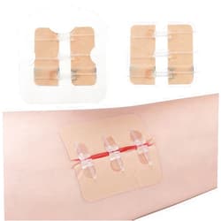 Longmed Emergency Waterproof Wound Closure Strips Butterfly Bandages Stitch Sutures Adhesive Bandages for First Aid Zipper Laceration Repair Without Stitches for Wound Care