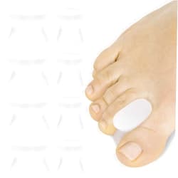 VIVEsole Silicone Toe Spacers (8 Pack) - Gel Toe Separators For Women & Men - Orthotic Dividers For Bunions, Overlapping Toes, Pain Relief - Big Toes Spreaders, Alignment & Corrector