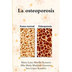 Spanish Edition by Maria Luisa Morillo Romero (Author), Alba María Martínez Guerrero (Author), Sara López Ramírez (Author) & 1 more La osteoporosis (Spanish Edition)