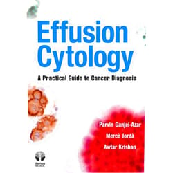 By Parvin Ganjei-Azar MD (Author), Merce PhD Jorda (Author), Awtar PhD Krishan (Author) & 0 more Format: Kindle Edition Effusion Cytology: A Practical Guide to Cancer Diagnosis