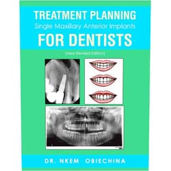 Dr Nkem Obiechina Treatment Planning Single Maxillary Anterior Implants for Dentists