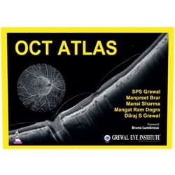 By SPS Grewal (Author), Manpreet Brar (Author), Mansi Sharma (Author), Mangat Ram Dogra (Author), Dilraj S Grewal (Author) & 1 more Format: Kindle Edition OCT Atlas
