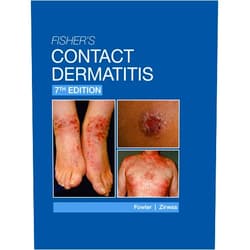 Joseph F. Fowler,Matthew J. Zirwas Fisher's Contact Dermatitis - 7th Edition