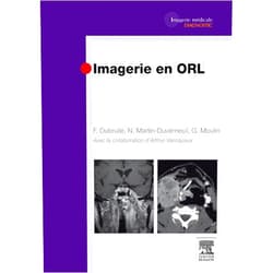 Frédérique Dubrulle,Nadine Martin-Duverneuil,Guy Moulin,Arthur Varoquaux,Catherine Alaeddine-Lejalle,Christopher Bourdet,Brigitte Bourlière,Hervé Brunel,Pierre Cassagneau,Delphine Caudal,Christophe Chagnaud,Pierre Champsaur,Frédérique Chapon,Jean-Baptiste Charrier,Dominique Chevalier,Mélika Amor-Sahli,Frédéric Clarençon,Frédéric Cohen,Fabien Craighero,Arnaud DEVEZE,Florian Desmot,Philippe Dory-Lautrec,Aurélie Drier,Aïda EL AMRI,David Facon,Jean-Claude Ferrié,Farida BENOUDIBA,Loïc Gaillandre,Jean-Christophe Gentric,Nadine Girard,Daphné Guenoun,Alexis Jacquier,Jean-Michel Klossek,Guillaume LOUIS,Jean-Pierre Lavieille,Marine Lefèvre,Cyril MULLER,Mokran BOUKHELIFA,Jacques Paul Magnan,Sandrine Marciano-Chagnaud,Claude Marsault,Philippe Meriot,Olivier Monnet,Sophie Périé,Gilles Piana,Jean-Daniel Piekarski,Géraldine Placko-Parola,Pascale SILES,Axelle Bailhache,Raphaëlle Souillard-Scemama,Marc Tassart,Jean-Marc Thomassin,Vincent VIDAL,Emilie Wikberg-Lafont,Marc Williams,Jean-Michel Bartoli,Raphaël Blanc,Florence Boccara-Rodriguez,Fabrice Bonneville Imagerie en ORL (French Edition)