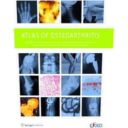 Nigel Arden,Francisco Blanco,C. Cooper,Ali Guermazi,Daichi Hayashi,David Hunter,M. Kassim Javaid,Francois Rannou,Frank Roemer,Jean-Yves Reginster Atlas of Osteoarthritis
