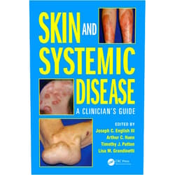 Joseph C. English III,Arthur C. Huen,Timothy J. Patton,Lisa M. Grandinetti Skin and Systemic Disease: A Clinician's Guide