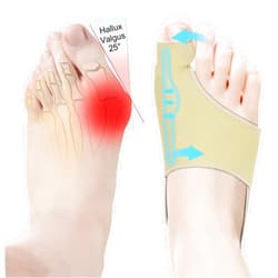 HLOES 2Pcs Bunion Corrector for Women Big Toe Straightener-Bunion Splint-Bunion Pads for Bunion Relief-Hallux Valgus Pain Relief,Comfortable & Breathable for Day/Night