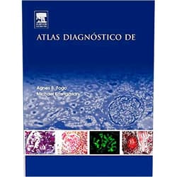 Spanish Edition by Agnes B. Fogo MD (Author), Michael Kashgarian MD (Author) Atlas diagnóstico de patología renal (Spanish Edition)