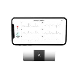 AliveCor KardiaMobile 6-Lead Personal EKG Monitor – Six Views of The Heart – Detects AFib and Irregular Arrhythmias – Instant Results in 30 Seconds – Works with Most Smartphones - FSA/HSA Eligible