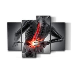UJOYAFZSIM Orthopedic Human Anatomy Medical Poster Back pain conceptual artwork 3d Wall Art Decor for Doctor Office Clinic Gift for Nurse Physicians Assistant Physical Therapist