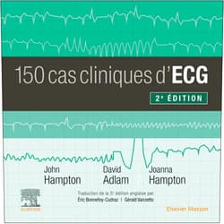 French Edition by David Adlam (Author), Joanna Hampton (Author), John R. Hampton (Author), Claire GUILABERT (Editor), Gérald Vanzetto (Translator), Eric Bonnefoy-Cudraz (Translator) & 2 more Format: Kindle Edition 150 cas cliniques d'ECG (French Edition)