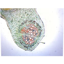 EISCO 10PK Legume Root Nodule - Prepared Microscope Slides - Classroom Pack, 10 Slides in Storage Case - Biology & Microscopy