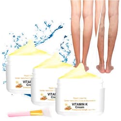 FACECOI Vitamin K Cream, Varicose Veins Miracle Cream, Spider Varicose Veins Miracle Cream, Remove Varicose Veins for Legs (3pcs)
