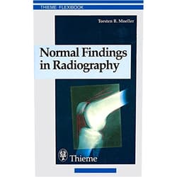By Torsten B. Moeller (Author) Normal Findings in Radiography (Thieme Flexibook) by Torsten Bert Moeller (1999-10-28)