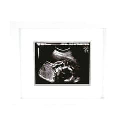 Pearhead Sonogram Photo Frame, Wall Mount An Tabletop Picture Frame, Baby Ultrasound Keepsake, White