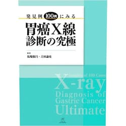 Japanese Edition by Yasumasa Baba Toshifumi Yoshida (Author), Yasumasa Baba (Author), Toshifumi Yoshida (Author) & 0 more Format: Kindle Edition X-ray Diagnosis of Gastric Cancer Ultimate: Insights of 100 Cases (Japanese Edition)