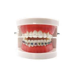 RUCYAI Dental Standard Teeth Model Typodont Metal/Ceramic Brackets for Demonstration (Ceramic)