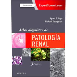 Spanish Edition by Agnes B. Fogo (Author), Michael Kashgarian (Author), SL DRK EDICIÓN (Translator) & 0 more Format: Kindle Edition Atlas diagnóstico de patología renal (Spanish Edition)