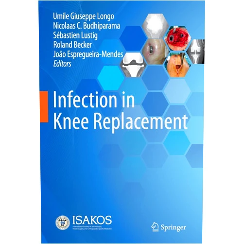 By Umile Giuseppe Longo (Editor), Nicolaas C. Budhiparama (Editor), Sébastien Lustig (Editor), Roland Becker (Editor), João Espregueira-Mendes (Editor) & 1 more Format: Kindle Edition Infection in Knee Replacement