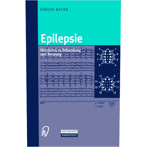 Jürgen Bauer Epilepsie: Nützliches zu Behandlung und Beratung (German Edition)