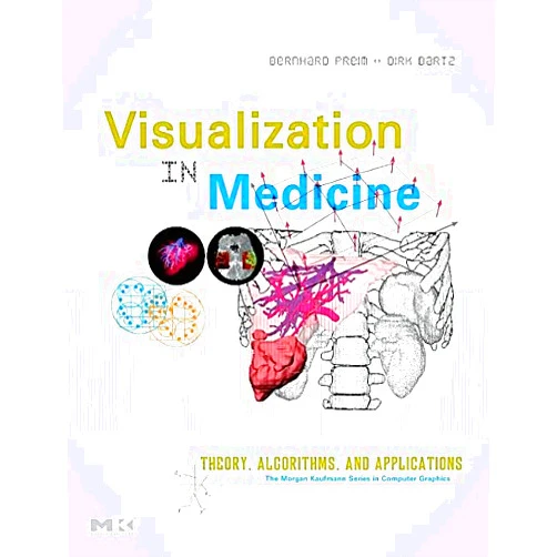 Bernhard Preim,Dirk Bartz Visual Computing for Medicine: Theory, Algorithms, and Applications (The Morgan Kaufmann Series in Computer Graphics)