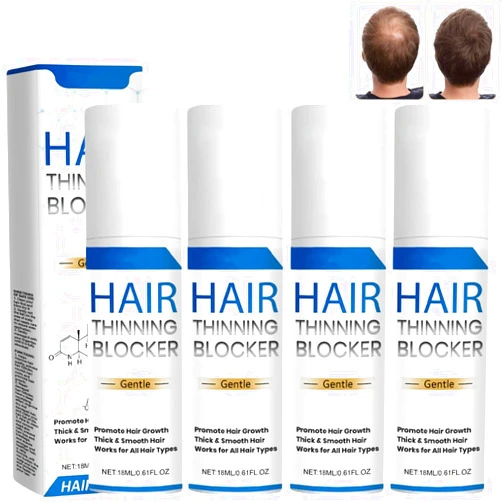Vrpshe Genthair DHT for Men, Genthair Hair Growth Roller, Genthair DHT Roll On for Men, Gent Hair DHT Blocker, Hair Growth Serum (2) (4 pcs)