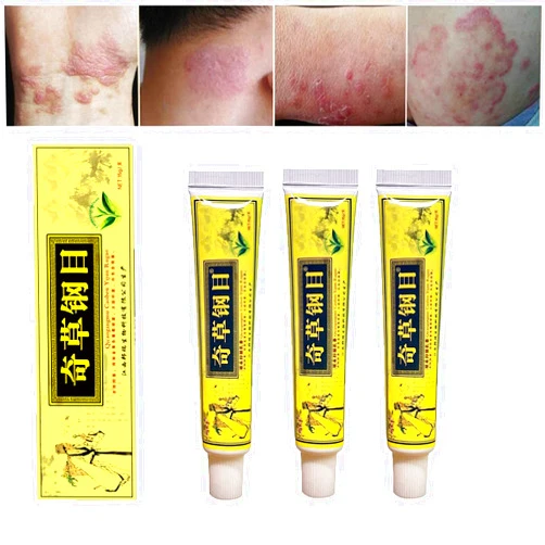 Lointgh Traditional Herbal Eczema Healing Cream, Organic Eczema Herbal Healing Cream, Chinese Herbal Eczema, Psoriasis Creams Dermatitis and Eczema Pruritus Psoriasis Ointment (3PCS)