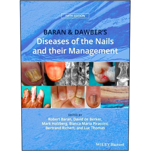 By Robert Baran (Editor), David A. R. de Berker (Editor), Mark Holzberg (Editor), Bianca Maria Piraccini (Editor), Bertrand Richert (Editor), Luc Thomas (Editor) & 2 more Format: Kindle Edition Baran and Dawber's Diseases of the Nails and their Management