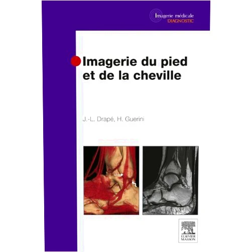 French Edition by Jean-Luc Drapé (Author), Henri Guerini (Author), Catherine Adamsbaum (Contributor), Alain Chevrot (Contributor), Jean-Pierre Courpied (Contributor), Gilles Desportes (Contributor), Jean-Bernard Elis (Contributor), Michel Fermand (Contributor), Antoine Feydy (Contributor), Didier Godefroy (Contributor), Françoise L'Huillier (Contributor), Philippe MATHIEU (Contributor), Lamya MEZITI (Contributor), Philippe Anract (Contributor), Atossa MINOUI (Contributor), Sébastien Malan (Contributor), Dominique Medevielle (Contributor), Valérie Merzoug (Contributor), Aline Mirat (Contributor), Gérard Morvan (Contributor), Laurence Moutounet (Contributor), Eric Pessis (Contributor), Etienne Pluot (Contributor), Jérôme Renoux (Contributor), Fabienne Bach (Contributor), Delphine Richarme (Contributor), Julien Rousseau (Contributor), Laurent Sarazin (Contributor), Nicolas Theumann (Contributor), Fabrice Thevenin (Contributor), Bernard Tomeno (Contributor), Delphine Zeitoun-Eiss (Contributor), Géraldine Bach (Contributor), Andras Barta (Contributor), Jean-Louis Brasseur (Contributor), Raphaël Campagna (Contributor), Marie-Dominique Chancelier (Contributor), Nathalie Chemla (Contributor) & 35 more Format: Kindle Edition Imagerie du pied et de la cheville (Imagerie médicale : diagnostic) (French Edition)
