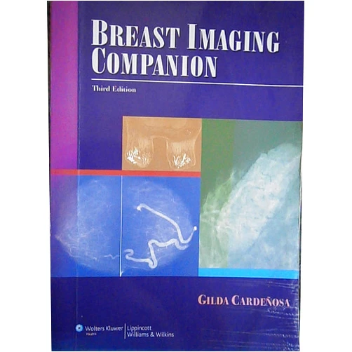 Gilda Cardenosa Breast Imaging Companion (Cardenosa, Breast Imaging Companion)