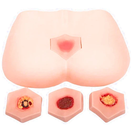 HaqUos 4 Stages of Bedsores Pressure Sore Model Decubitus Ulcer Training Model - for Teaching Education School Home Learning,Decubitus Wound Care Kit