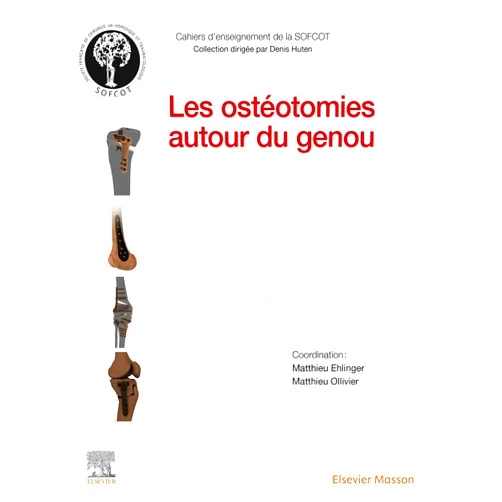 French Edition by Matthieu Ehlinger (Author), Matthieu OLLIVIER (Author), SOFCOT (Author), Jean-Noël Argenson (Author), Cyrille MARTINET (Illustrator) & 1 more Format: Kindle Edition Les ostéotomies autour du genou (French Edition)