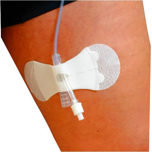 TIDI 3400LFC-10PK Grip-Lok Foley Catheter Securement Device ― Large ― Pack of 10 ― White ― Flexible Material ― Low-Profile Design for Comfort― Home Healthcare ― FSA Eligible Medical Supplies