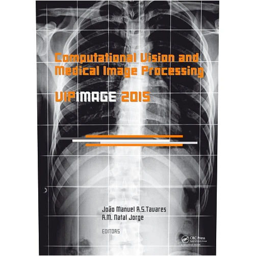 Joao Tavares,R.M. Natal Jorge Computational Vision and Medical Image Processing V: Proceedings of the 5th Eccomas Thematic Conference on Computational Vision and Medical Image Processing ... 2015, Tenerife, Spain, October 19-21, 2015)