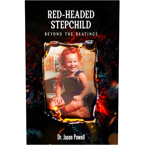 Dr. Jason Powell RED-HEADED STEPCHILD