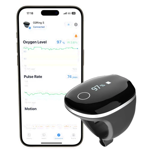 Wellue O2Ring-S Oxygen Monitor for Small Fingers | Rechargeable Pulse Oximeter, Continuous Blood Oxygen & Pulse Rate Tracking with Vibration Reminder | 24 hrs Battery Life, 4 * 10 Hours Data Storage
