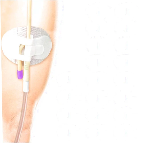 HNYG 20 Pack Statlock Catheter Holder,Catheter Stabilization Device,Catheter Urinary Leg Bag Legband Holder Sticker,Adhensive Catheter Leg Strap Hook and Loop,Catheter Supplies