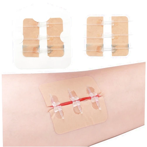 Longmed Emergency Waterproof Wound Closure Strips Butterfly Bandages Stitch Sutures Adhesive Bandages for First Aid Zipper Laceration Repair Without Stitches for Wound Care