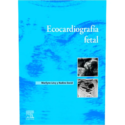 Maryline Lévy,Nadine DAVID Ecocardiografía fetal (Spanish Edition)