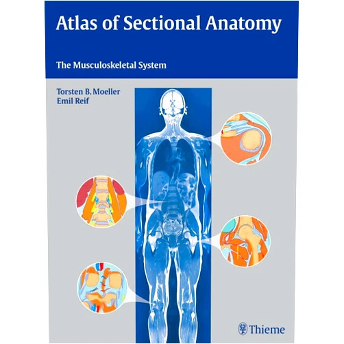 Torsten Bert Möller,Emil Reif Atlas of Sectional Anatomy: The Musculoskeletal System