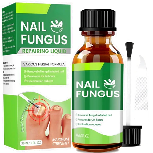 Calpol Toenail Fungus Treatment Extra Strength,Toenail Fungus Treatment,Nail Fungus Treatment for Toenail,Nail Fungus Treatment Extra Strength for Athletes Foot, Thick, Broken, Discolored & Damaged Nail30Ml