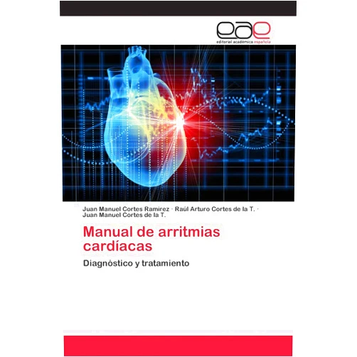 Juan Manuel Cortes Ramírez,Raúl Arturo Cortes de la T.,Juan Manuel Cortes de la T. Manual de arritmias cardíacas: Diagnóstico y tratamiento (Spanish Edition)