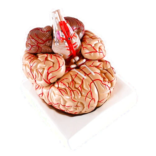 Cranstein Scientific Medical Anatomical Brain Model, with Arteries, 9 Parts, Life Size