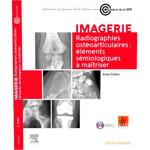 French Edition by Anne Cotten (Author), Carole FUMAT (Illustrator), Nadia Venturelli (Contributor), Sandrine Chilloh (Contributor), D. Safa (Contributor), Héloïse Lérisson (Contributor), Wilaume Thibault (Contributor), Guillaume Bierry (Contributor), Maxime Lacroix (Contributor), Robert Carlier (Contributor), Daniela Rapilat (Contributor), Nathalie Boutry (Contributor), Jean-Luc Drapé (Contributor), Elodie ROMAN (Contributor), Fatma Boubaker (Contributor), Adrien Felter (Contributor), Marie Faruch-Bilfeld (Contributor), Romain Gillet Gillet (Contributor), Valentin RENAULT (Contributor), Valérie Bousson (Contributor), Maud Crézé (Contributor), Guillaume Sarrot (Contributor), Edouard de Sousa (Contributor), Myriam Edjlali-Goujon (Contributor), Mohamed El Fayoumi (Contributor), Anne Matthews-Gaulon (Contributor), Pedro Augusto Gondim Teixeira (Contributor), Annaelle Chetrit (Contributor), Antoine Feydy (Contributor), Catherine Cyteval (Contributor), Asma Louati (Contributor), Alain Blum (Contributor), Paul Michelin (Contributor), Jacques Malghem (Contributor), Valérie Merzoug (Contributor), Charlotte Chiri (Contributor), Charbel Mourad (Contributor), Amine Ammar (Contributor), Bruno C. Vande Berg (Contributor) & 35 more Format: Kindle Edition Radiographies ostéoarticulaires : éléments sémiologiques à maitriser (French Edition)