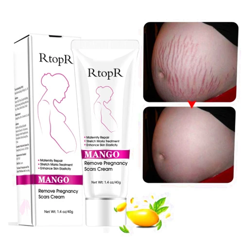 YG LianKai Mango Stretch Marks and Scar Cream, Stretch Mark and Scar Removal Cream for Pregnancy, Belly Creams for Wrinkles, Obesity Fat Marks Scars Moisturizing, Remove Marks (40g)