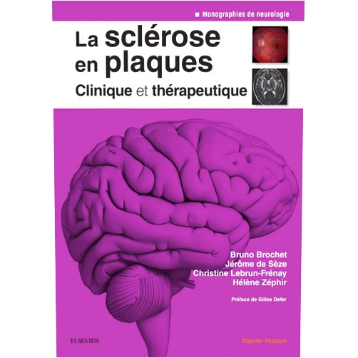 Bruno Brochet,Jérôme de Sèze,Christine Lebrun-Frenay,Hélène Zéphir,Sophie Jeleff,Gilles Defer,Nicolas Collongues,Pierre Labauge,David Brassat,Anne Blanchard-Dauphin,Patrice Lalive,Jean Pelletier,Eric Thouvenot,Bertrand Audoin,Gilles Edan,Alain Créange,Olivier Outteryck,Xavier Moisset,Agnès Fromont,Aurélie Ruet,Cécile Donzé,Caroline Harand,Anne-Laure Ramelli,David Veillard,Etienne Allart,Catherine Vignal-Clermont,Fabienne Pelé,Olivier Gout,Marianne de Seze,Sandra Vukusic,Clarisse Carra,Béatrice Jenny,Claire Guillon,Philippe Marque,Xavier Gamé,Mikael Cohen,Sophie Pittion-Vouyovitch,Xavier Ayrignac,Laure MICHEL,Caroline Bensa,Marc Debouverie,Emmanuelle Le Page,Pierre Clavelou,Jean-Christophe Ouallet La sclérose en plaques - Clinique et thérapeutique (Neurologie) (French Edition)