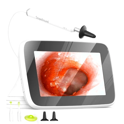 ScopeAround Digital Otoscope with Light, Ear Cleaning Camera and Wax Remover, Visual Ear Cleaner with 4.3