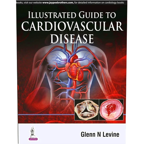 By M.D. Levine, Glenn N. (Author) Illustrated Guide to Cardiovascular Disease